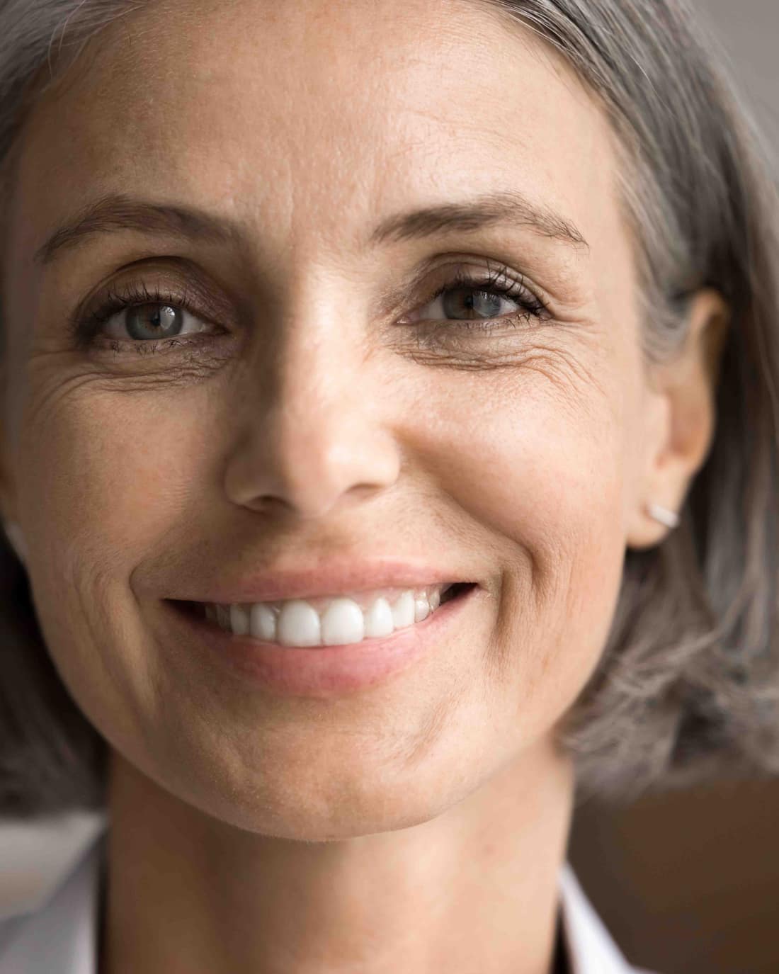 A confident Melbourne patient smiling after dental implant treatment
